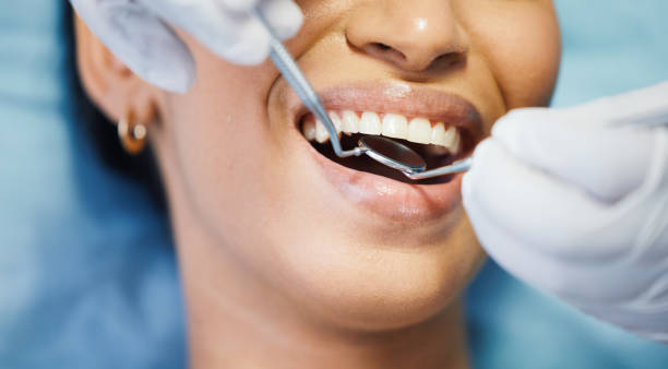 Best Broken or Chipped Tooth Repair in , IL